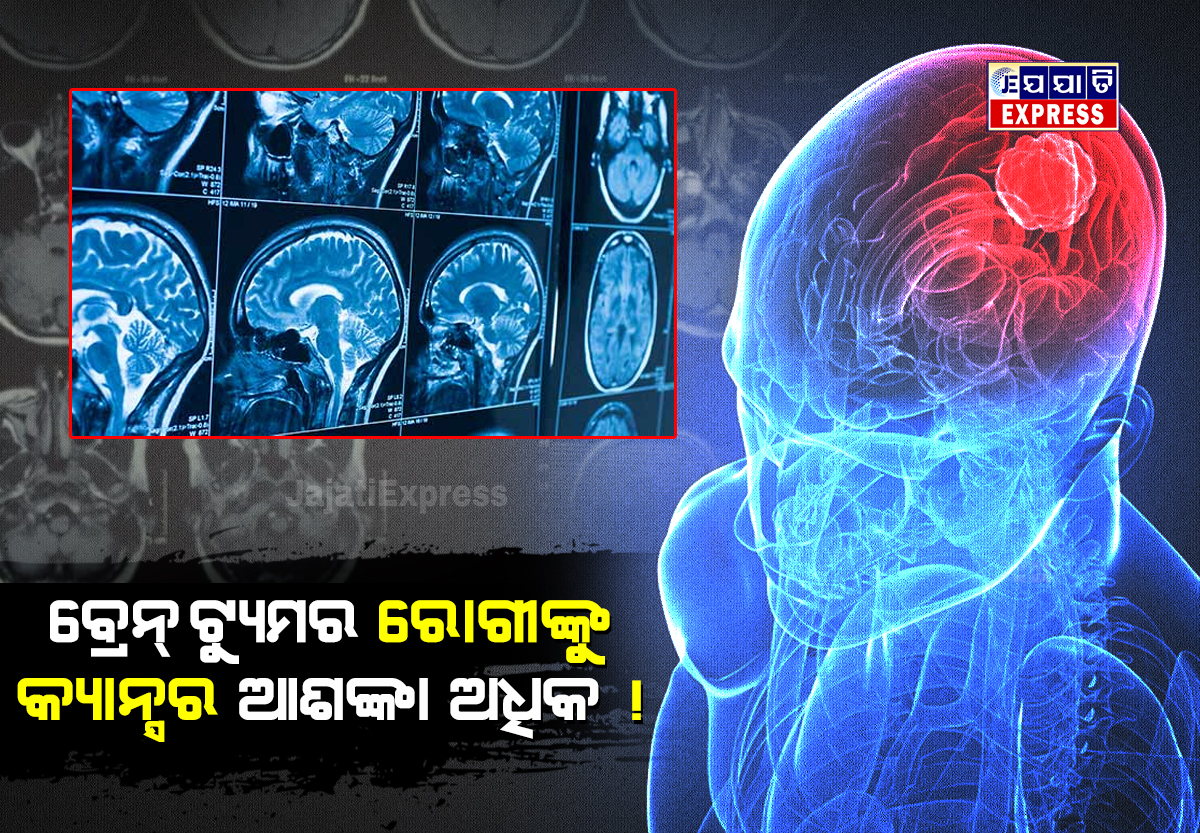 ବ୍ରେନ ଟ୍ୟୁମର ରୋଗୀଙ୍କୁ କ୍ୟାନ୍ସର ହେବର ସମ୍ଭାବନା ଅଧିକ